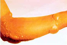 Photo of Pesce vescicante