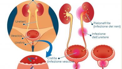 Photo of Cistite o infezione urinaria: sintomi, cause e rimedi naturali per combatterla